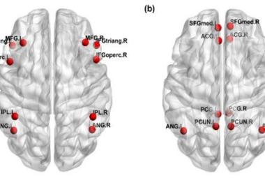 FIGURE 1: Brain areas of the (a) frontoparietal network and (b) default-mode network based on Automated Anatomical Labelling. MFG: Middle frontal gyrus; IFGoperc: Inferior frontal gyrus opercularis; IFGtriang: Inferior Frontal gyrus triangularis; IPL: Inferior parietal lobe; ANG: Angular gyrus; SFGmed: Superior medial frontal gyrus; ACG: Anterior cingulate gyrus; PCG: Posterior cingulate gyrus; PCUN: Precuneus. For variance analysis of functional connectivity, ‘.L’ and ‘.R’ represented the left and right he