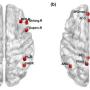 FIGURE 1: Brain areas of the (a) frontoparietal network and (b) default-mode network based on Automated Anatomical Labelling. MFG: Middle frontal gyrus; IFGoperc: Inferior frontal gyrus opercularis; IFGtriang: Inferior Frontal gyrus triangularis; IPL: Inferior parietal lobe; ANG: Angular gyrus; SFGmed: Superior medial frontal gyrus; ACG: Anterior cingulate gyrus; PCG: Posterior cingulate gyrus; PCUN: Precuneus. For variance analysis of functional connectivity, ‘.L’ and ‘.R’ represented the left and right he