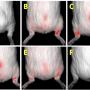 FIGURE 4: Tracking the presence of the labeled WJ-MSCs with PKH26 fluorescent dye after intra-articular injection of cells in guinea pigs using IVIS Lumina III imaging. (A) No fluorescent signal was detected before WJ-MSC injection on day 0; (B) A high-intensity fluorescent signal was detected on the right hind knee on day 0 immediately after knee intra-articular injection with WJ-MSCs; (C) On day 7, there was a fluorescent signal from the bilateral knee and caudal region of the guinea pig’s body, which cou